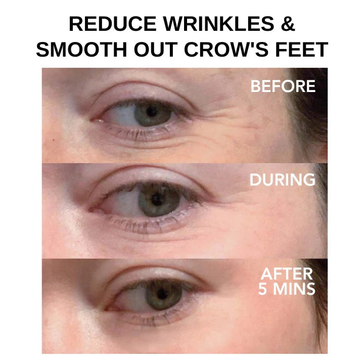 Clinical SkinCare Instant Eye Tightener